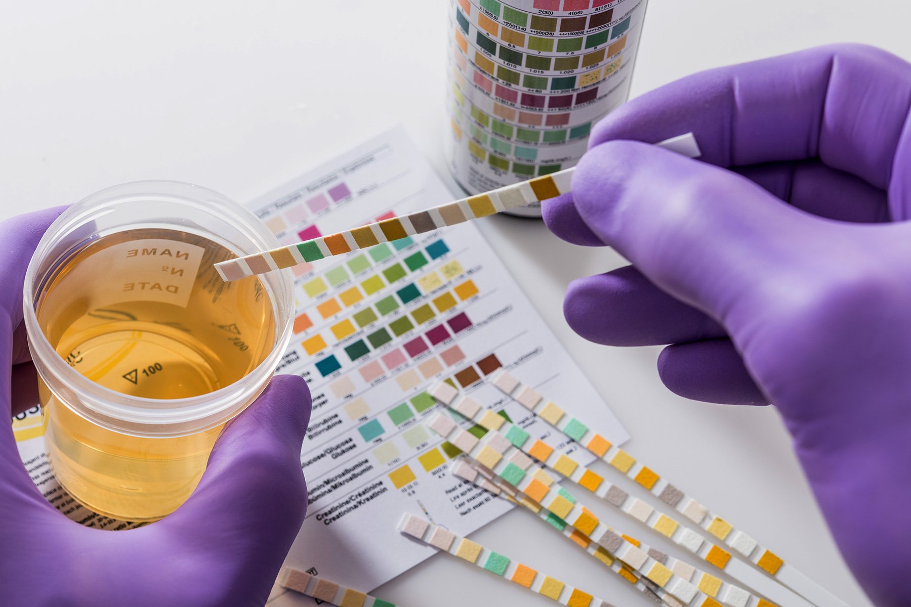 Workplace Drug Testing: 7 Reasons Not to Drug Test Employees